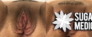 sugarlandmedspa  0002 non invasive patient1